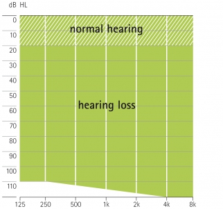 аудиограмма слухового аппарата Phonak CROS 13