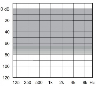 аудиограмма слухового аппарата Widex Dream D30-FS